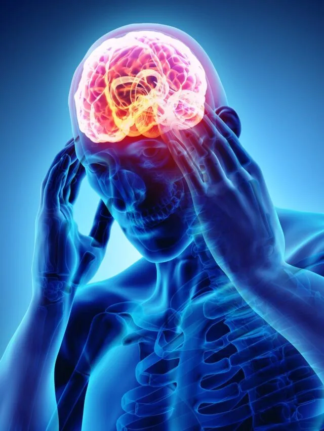 11 Migraine Misunderstandings