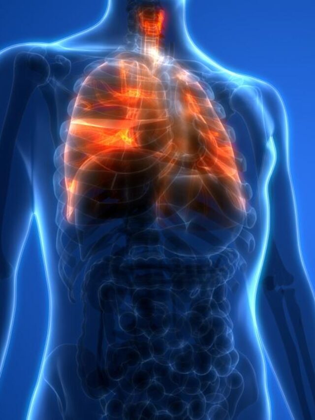 Medical Myths: All About Lung Cancer