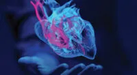 Cardiomyopathy