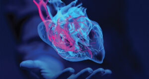 Cardiomyopathy