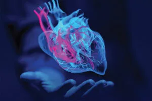 Cardiomyopathy