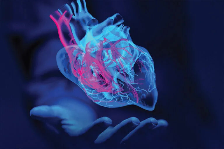 Cardiomyopathy