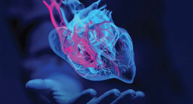 Cardiomyopathy
