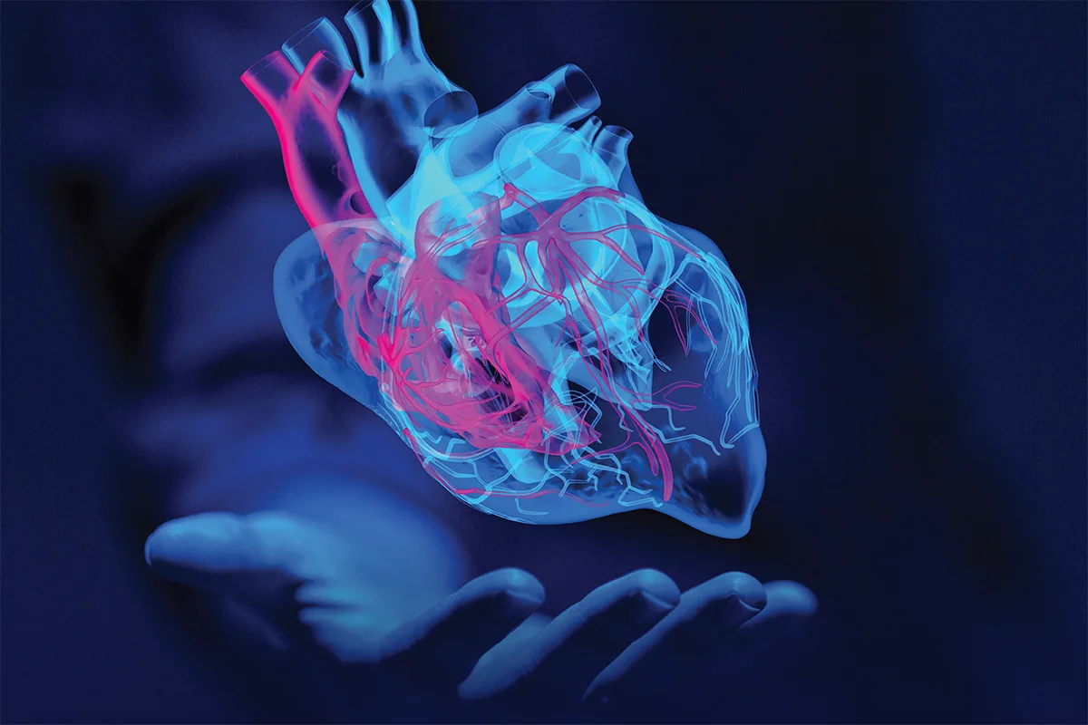 Cardiomyopathy